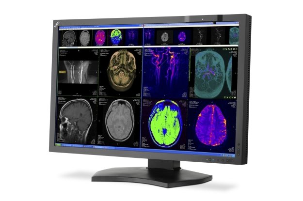 Monitor diagnostyczny  NEC MD302C4