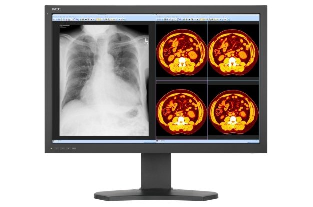 NEC MD302C6  – monitor medyczny o rozdzielczości 6 megapikseli
