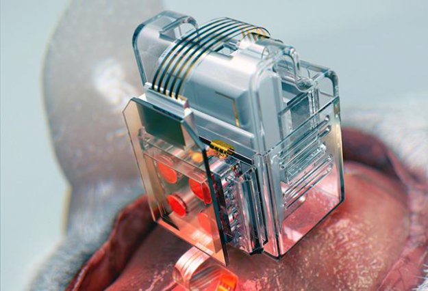 Smartfon pomaga kontrolować dostarczanie leków do mózgu