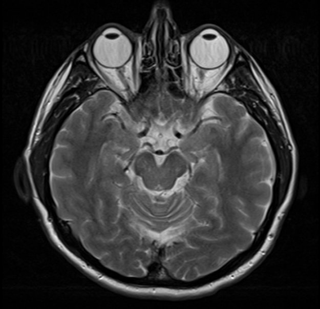 Oprogramowanie do identyfikacji twarzy w medycynie