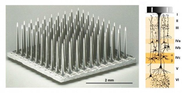 Domózgowy implant przywróci wzrok niewidomym